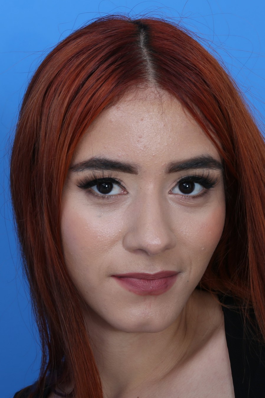 Photo HD Little Chloe - 3