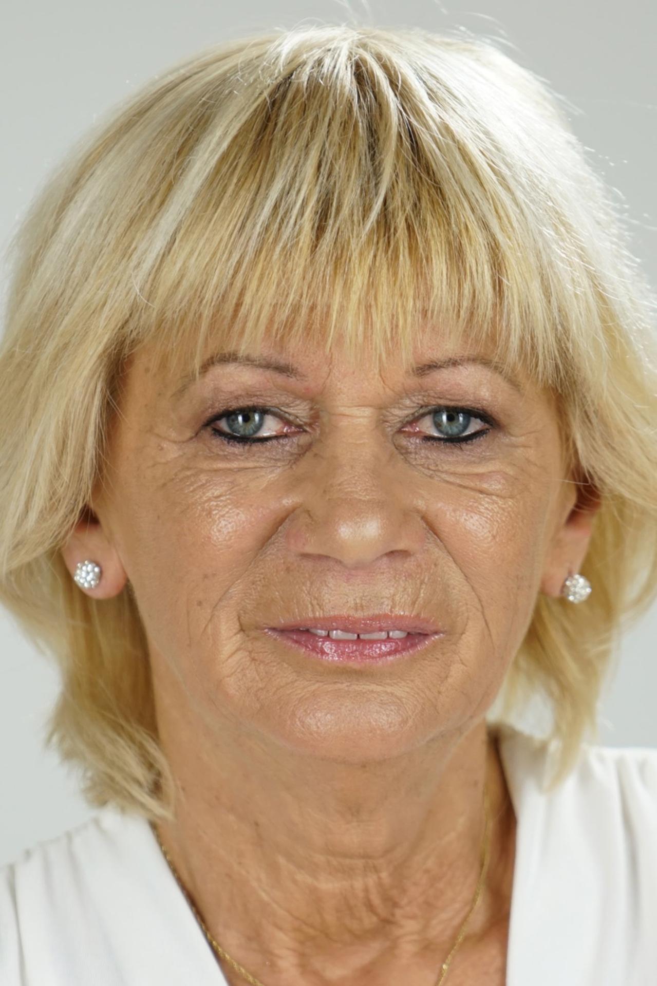 Diane Sheperd Facial