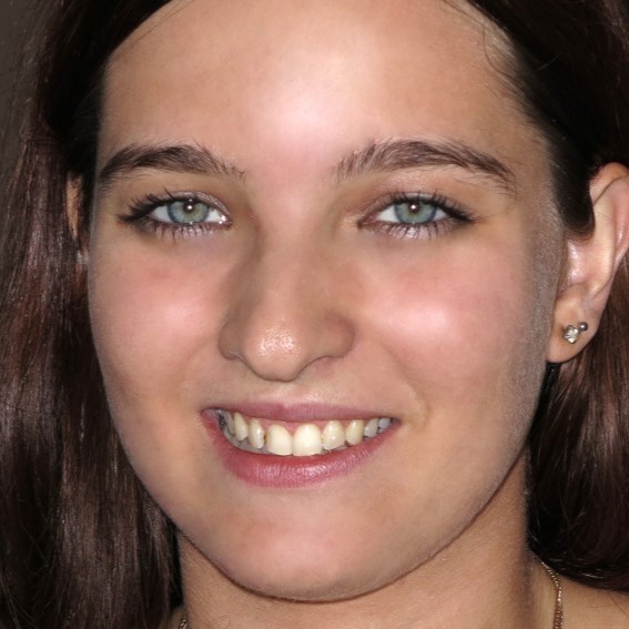 Brooke Azure Woodman Casting X