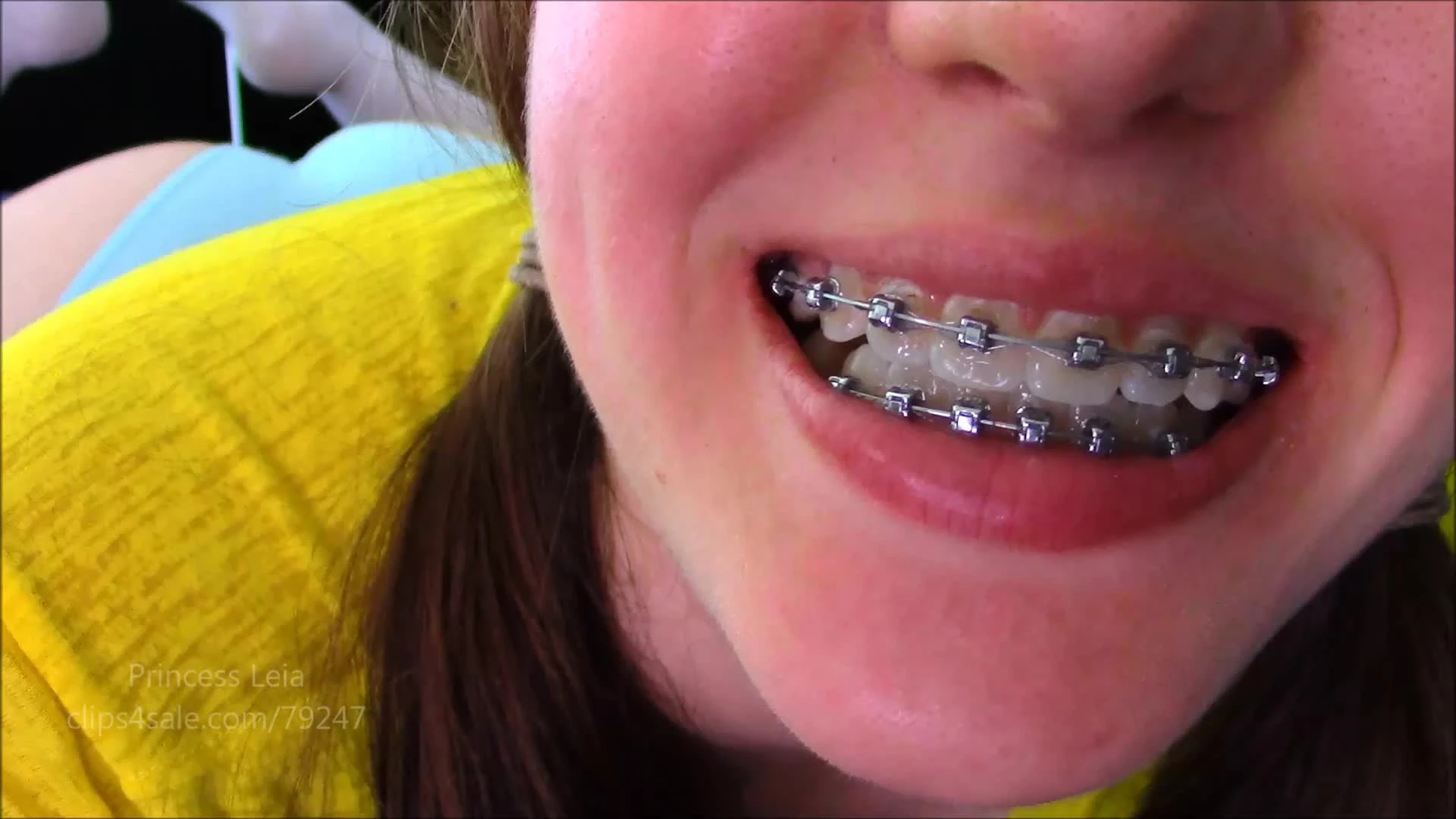 Leia's Braces JOI