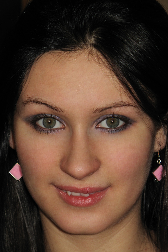 Photo HD Esmeralda Fox - 2