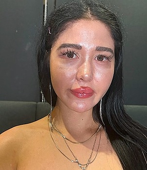 Photo HD Miu Miu - 1