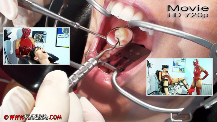 Dentist's Bondage - Part 2