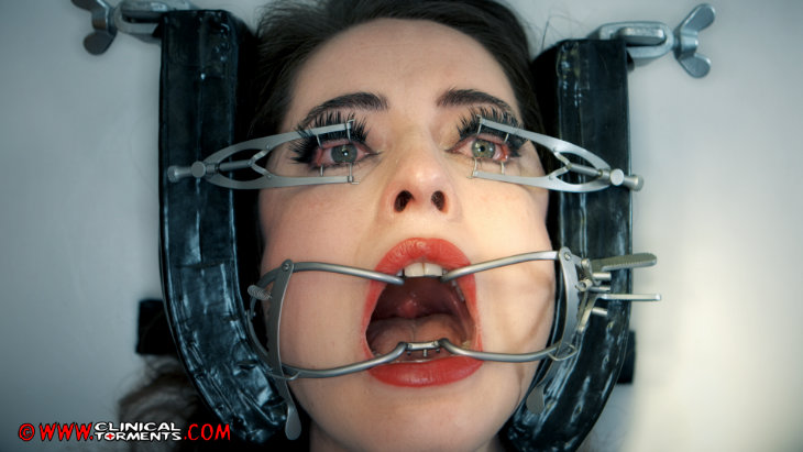 AT THE EYE SPECIALIST - PART TWO
