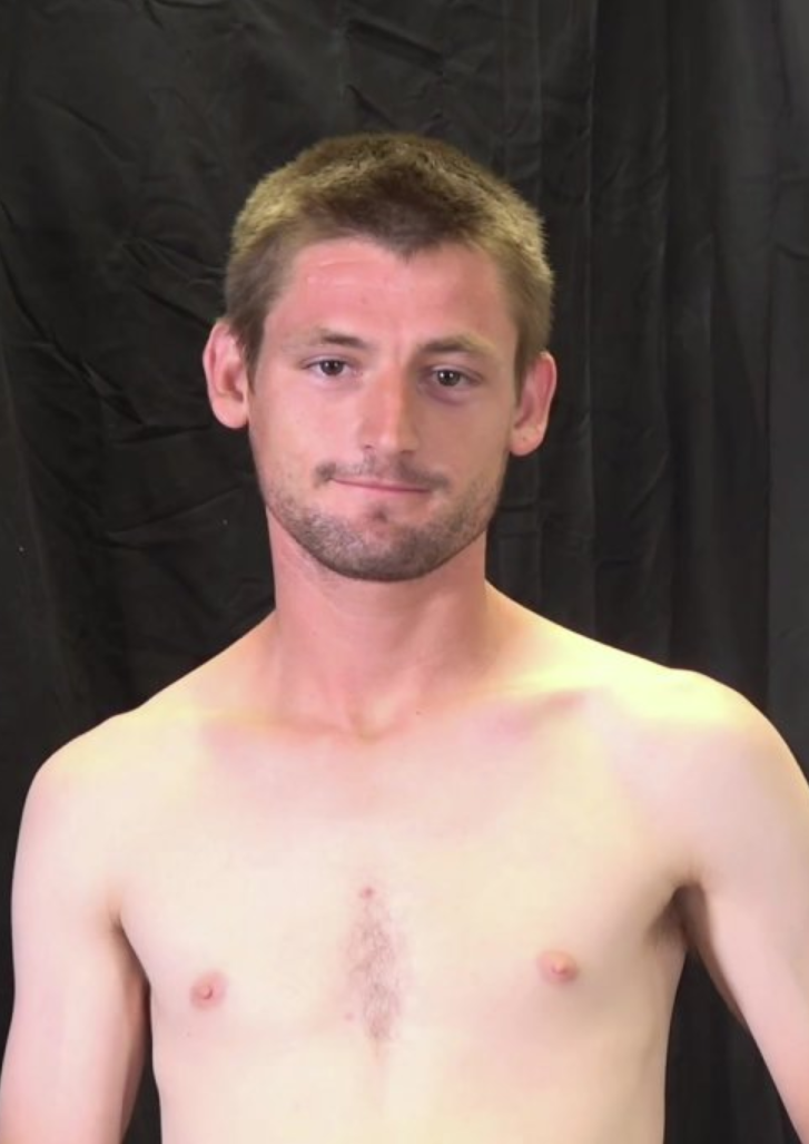 Nick Stallings Facial