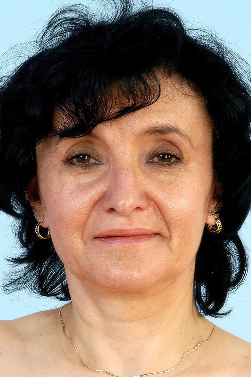 Tatana Husova Facial