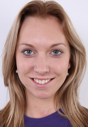 Photo HD Foxies Gold - 4