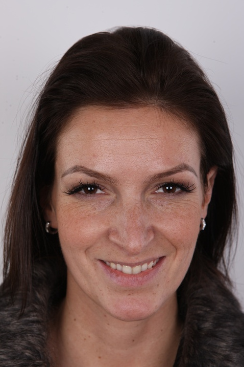 Diana V Czech Solarium