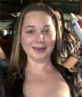 Chelsea Shupert Facial