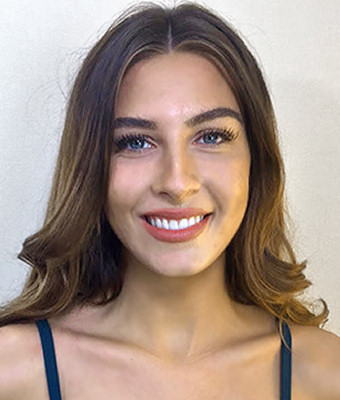 Photo HD Sunny Ray - 1