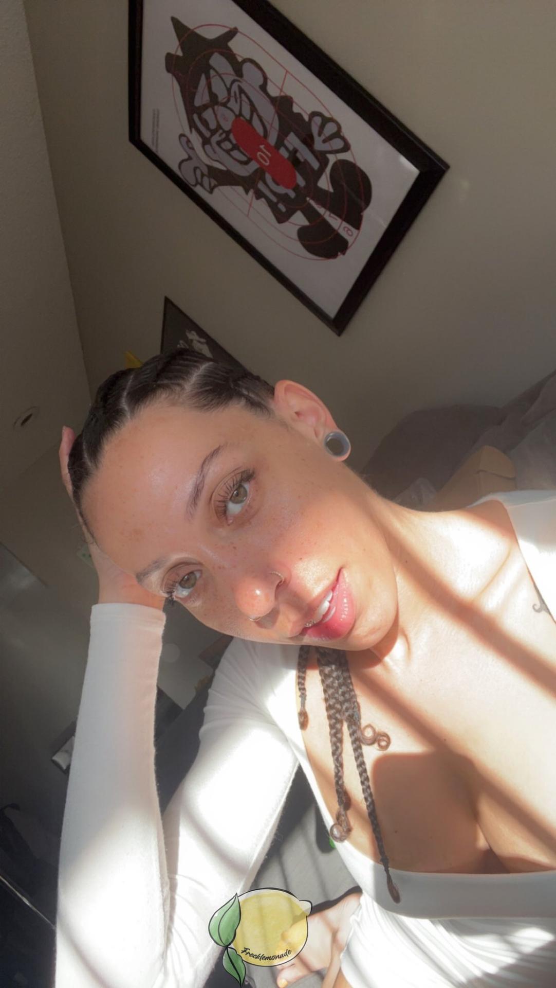 Photo HD Freckle Lemonade - 2