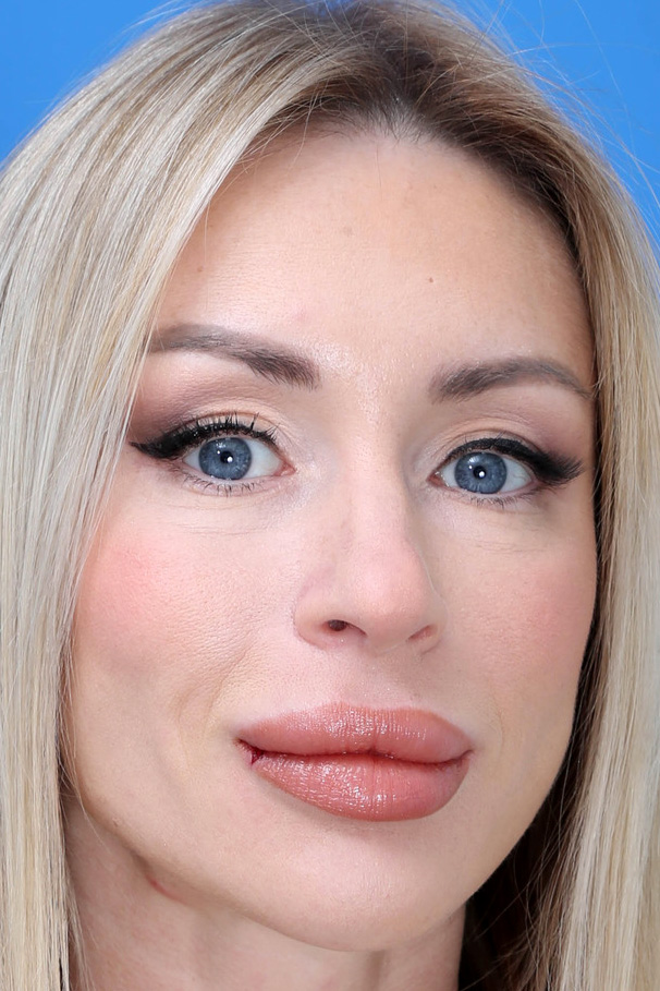 Stella Scandic Fisting