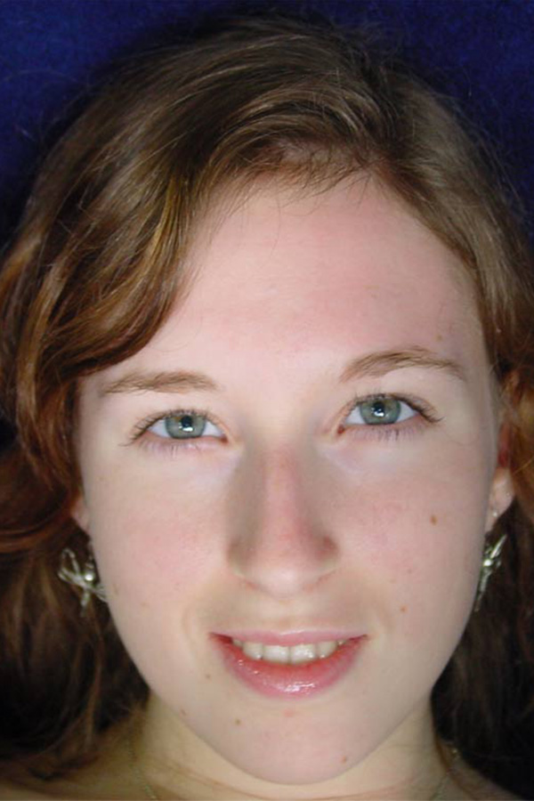 Photo HD Evangeline - 2