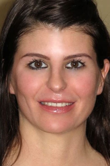 Suzy Schweider Woodman Casting X