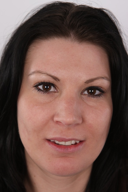 Stanislava Fellation