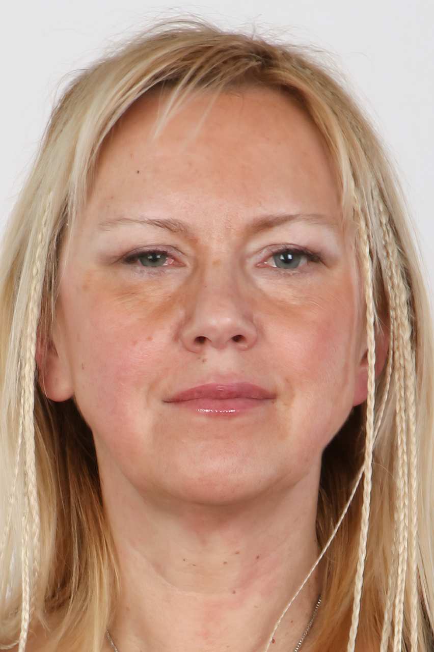 Drusella DeMille Facial