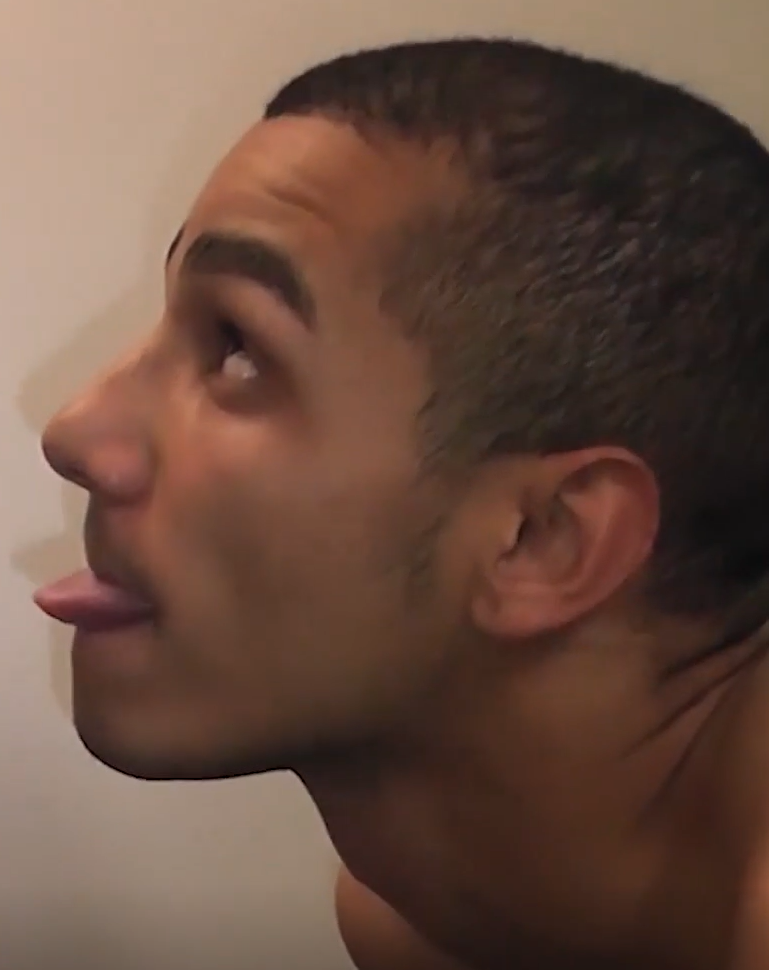 Taylor Murphy Facial