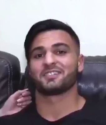 Anthony Ferrari Facial