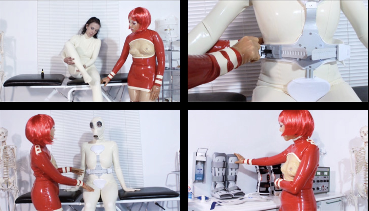Orthotic Bondage - Part Three