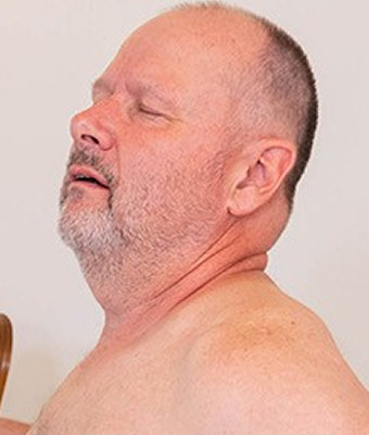 Hanz Peter Hagen Facial