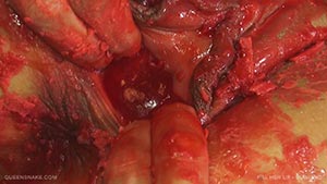 FILL HER UP - DIAMOND