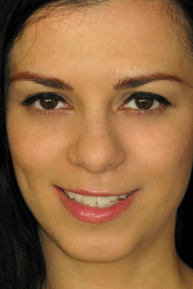 Photo HD Alice King - 7