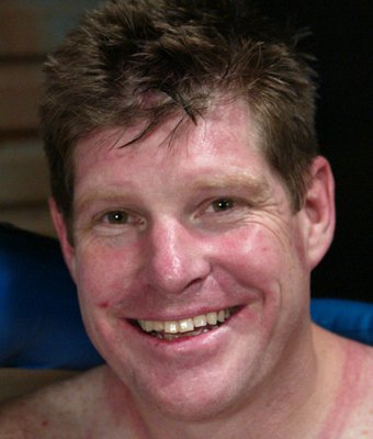 Sterling Ward Pegging