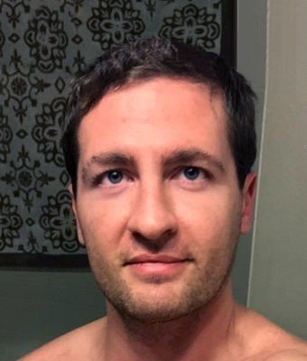 Daniel Archer Facial